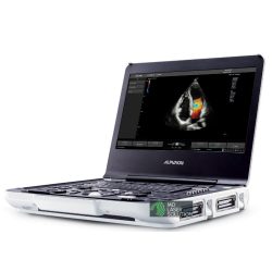 Alpinion X-CUBE i9 Ultrasound - Special Offers