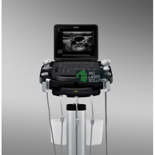 SonoSite Edge II Ultrasound - Special Offers