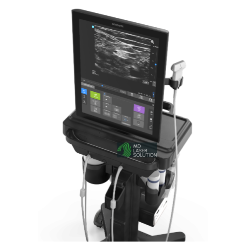 Sonosite ST Ultrasound - Special Offers